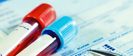 Fasting Blood Sugar | Fasting Blood Glucose | Calculator